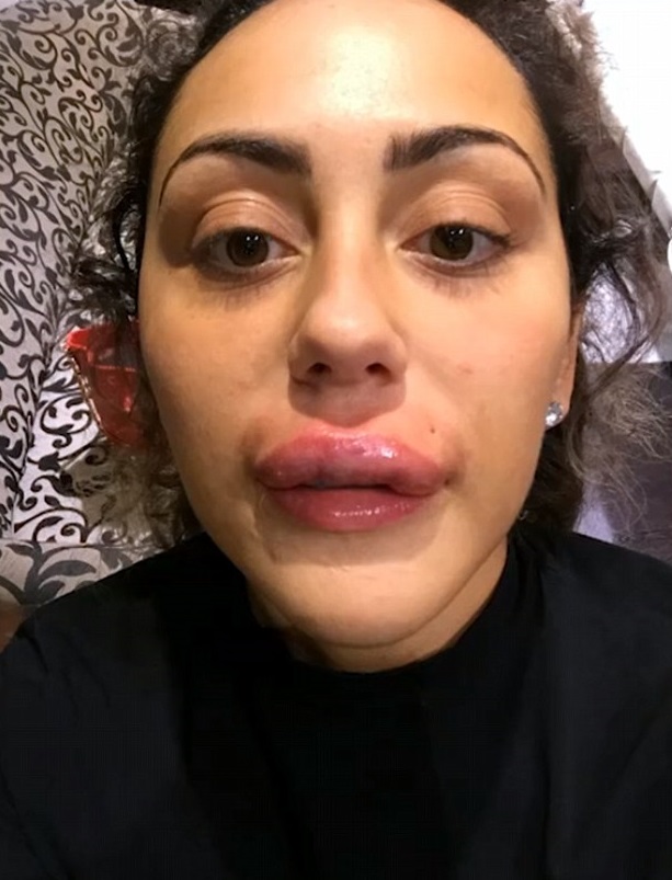 Sophie Kasaei on Celebrity Botched.