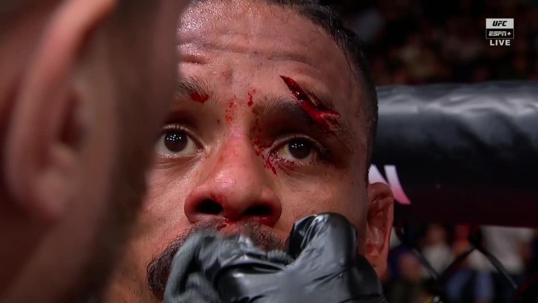 Close-up of a fighter's bloody face with cuts above his eyes.