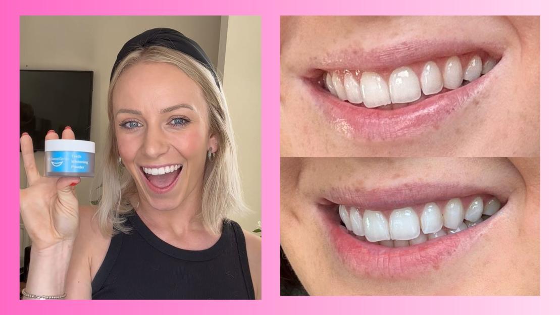 MySweetSmile dentist-approved teeth whitening range slashed by 30% in Amazon Spring Sale