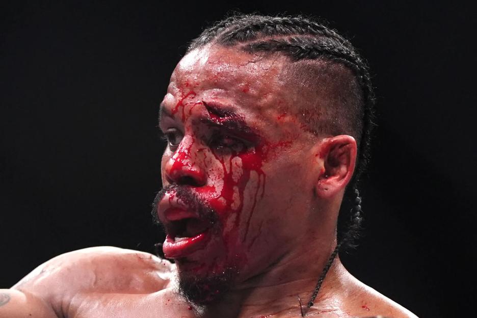 ‘Like a shark bite’ – UFC star left unable to see after horror cut on UFC London undercard leaving fans sickened