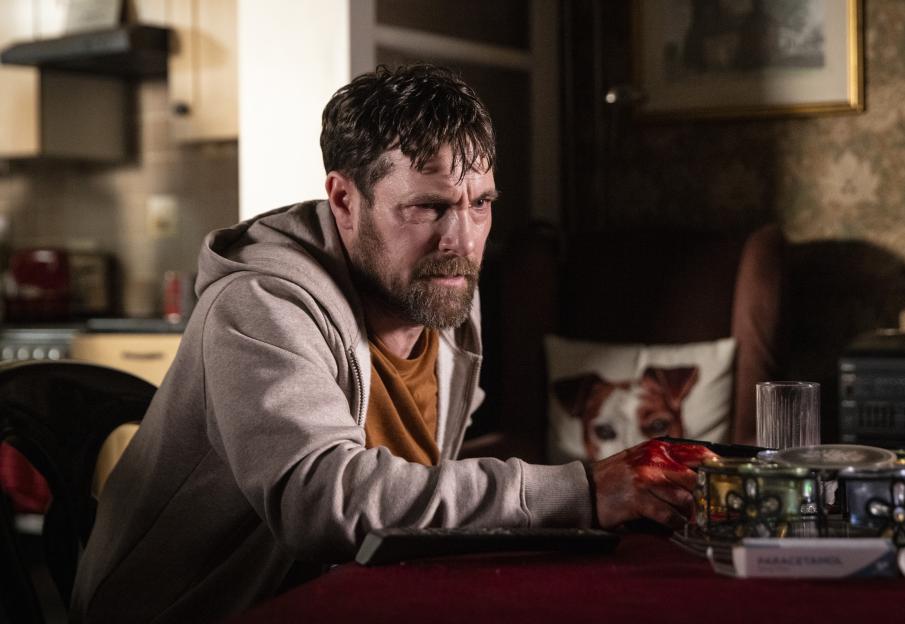 A man with blood on his hand sits at a table.