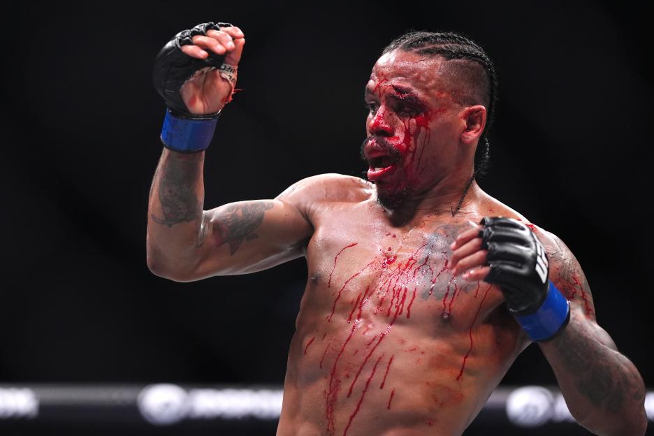 A bloody Chris Padilla celebrates during a UFC Fight Night lightweight bout.