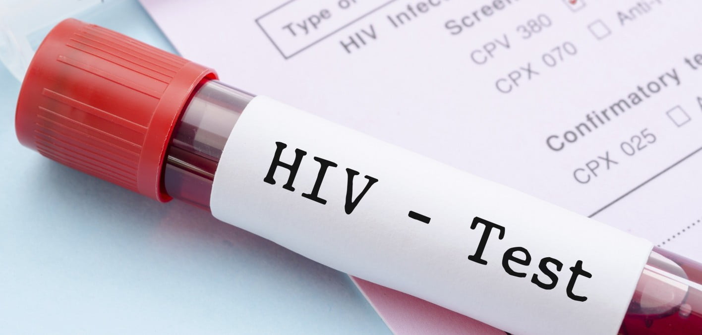 40 mass wedding candidates tested positive to HIV, pregnancy, others – Hisbah