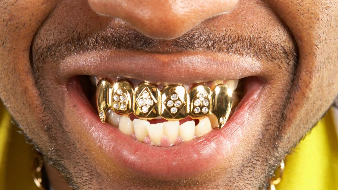 Cash-strapped Brits are flogging their gold teeth to pay bills, industry experts claim