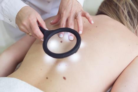 Doctor examining patient's moles with magnifying glass.