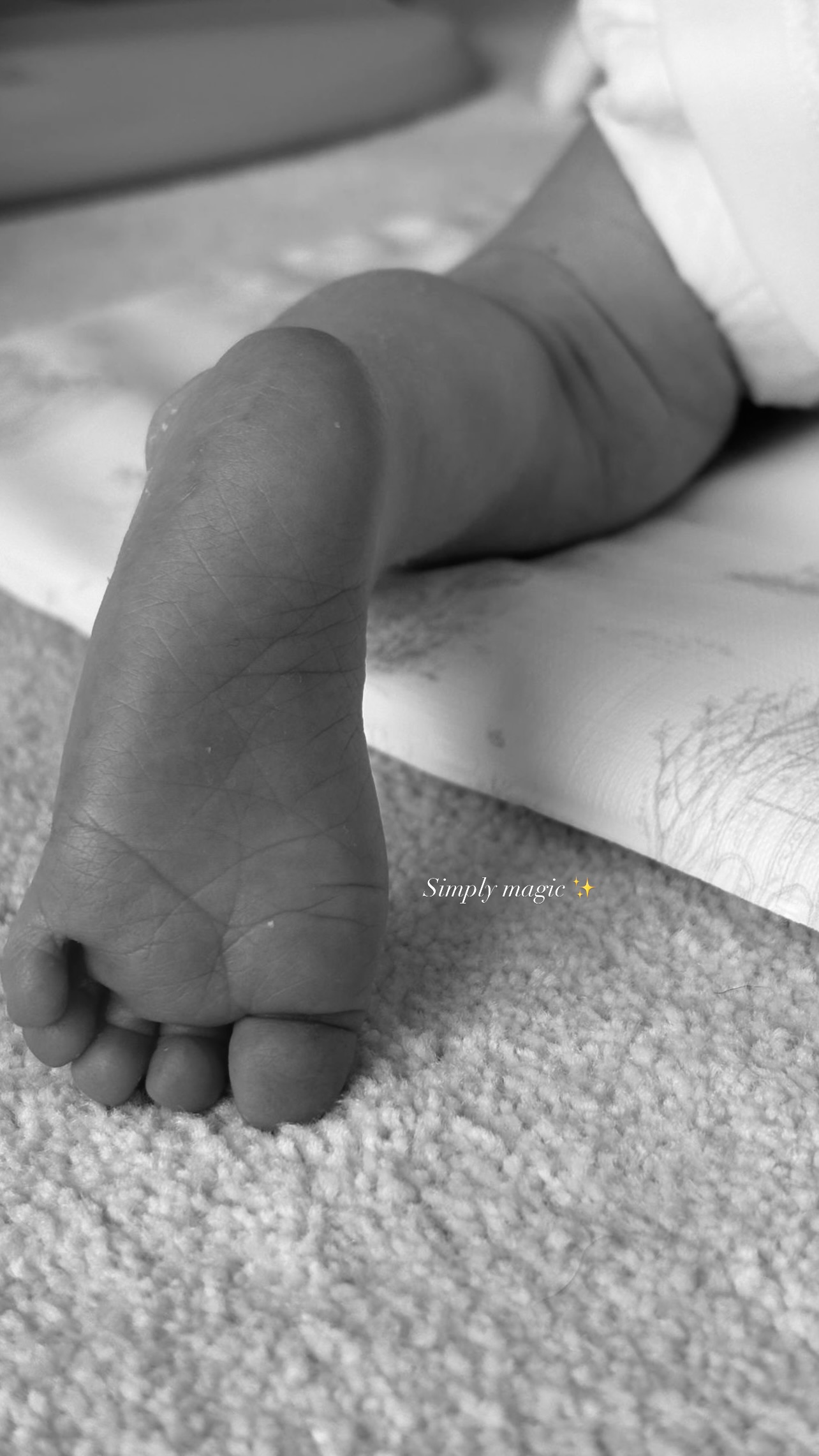 Black and white photo of a baby's foot.