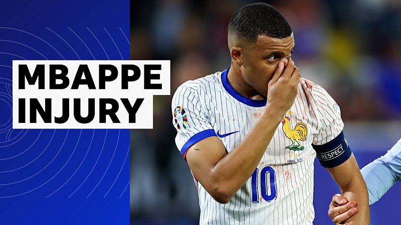 Mbappe 'not doing well' after nose injury